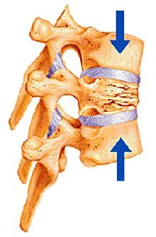 thoracic compression test|compression fracture of thoracic vertebra.